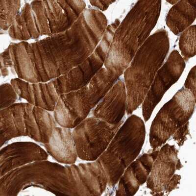 Immunohistochemistry-Paraffin: C8orf74 Antibody [NBP1-91039] - Staining of human skeletal muscle shows strong cytoplasmic positivity in myocytes.