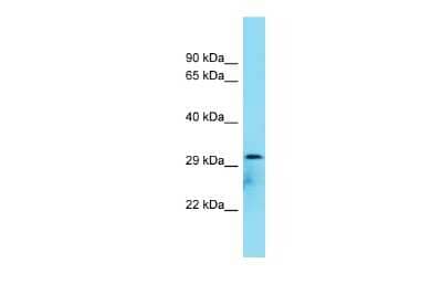 Western Blot: C8orf74 Antibody [NBP2-82952] - Host: Rabbit. Target Name: C8orf74. Sample Type: COLO205 Whole Cell lysates. Antibody Dilution: 1.0ug/ml