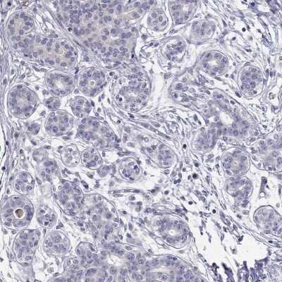 Immunohistochemistry-Paraffin: C8orf88 Antibody [NBP3-16961] - Staining of human breast shows low expression as expected.
