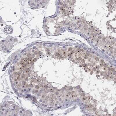 Immunohistochemistry-Paraffin: C8orf88 Antibody [NBP3-16961] - Staining of human testis shows high expression.