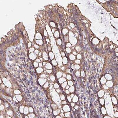 Immunohistochemistry-Paraffin: C9orf100 Antibody [NBP2-31850] - Staining of human colon shows moderate cytoplasmic and membranous positivity in glandular cells.