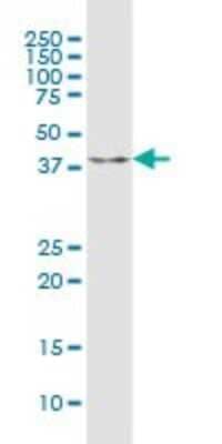 Western Blot: C9orf100 Antibody [H00084904-B02P] - Analysis of C9orf100 expression in human pancreas.