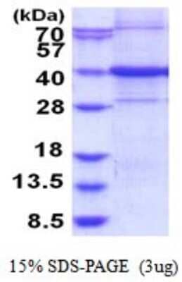 SDS-Page: C9orf100 Recombinant Protein [NBP2-51856] - 15% SDS Page (3 ug)