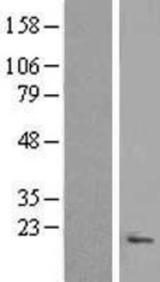 Western Blot: C9orf116 Overexpression Lysate (Adult Normal) [NBL1-08580] Left-Empty vector transfected control cell lysate (HEK293 cell lysate); Right -Over-expression Lysate for C9orf116.