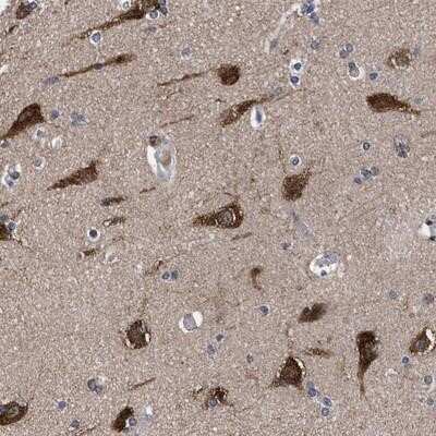 Immunohistochemistry-Paraffin: C9orf135 Antibody [NBP1-90684] - Staining of human cerebral cortex shows strong cytoplasmic positivity in neuronal cells.