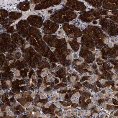 Immunohistochemistry-Paraffin: C9orf135 Antibody [NBP1-90685] - Staining of human stomach shows strong cytoplasmic positivity in Chief cells.