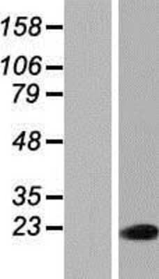Western Blot: C9orf142 Overexpression Lysate (Adult Normal) [NBP2-04782] Left-Empty vector transfected control cell lysate (HEK293 cell lysate); Right -Over-expression Lysate for C9orf142.