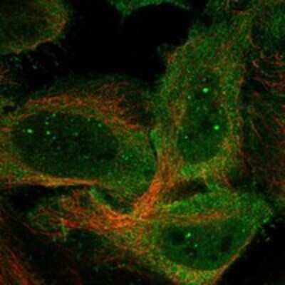 Immunocytochemistry/Immunofluorescence: C9orf153 Antibody [NBP3-17572] - Staining of human cell line HeLa shows localization to nuclear bodies, plasma membrane & vesicles.