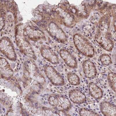 Immunohistochemistry-Paraffin: C9orf167 Antibody [NBP1-93983] - Staining of human stomach, upper shows moderate cytoplasmic positivity in glandular cells.