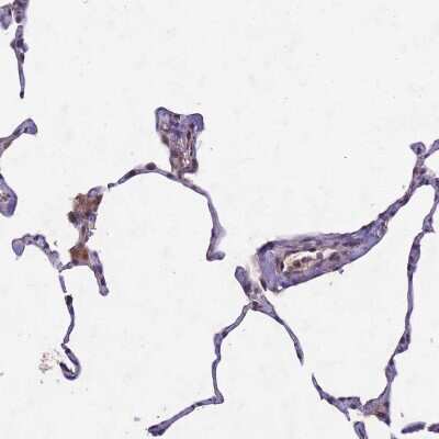 Immunohistochemistry-Paraffin: C9orf167 Antibody [NBP1-93983] - Staining of human lung shows moderate cytoplasmic positivity in pneumocytes and macrophages.