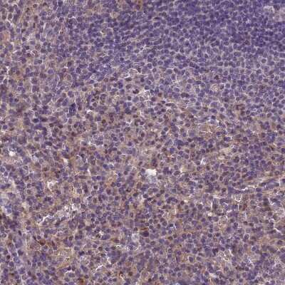 Immunohistochemistry-Paraffin: C9orf167 Antibody [NBP1-93983] - Staining of human spleen shows moderate cytoplasmic positivity in cells in red pulp.