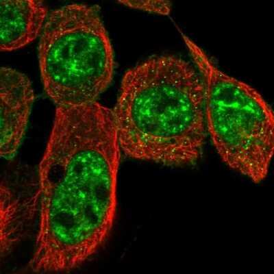 Immunocytochemistry/Immunofluorescence: C9orf169 Antibody [NBP1-81056] - Immunofluorescent staining of human cell line A-431 shows localization to nuclear speckles & vesicles.