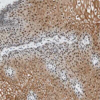 Immunohistochemistry-Paraffin: C9orf169 Antibody [NBP1-81056] - Staining of human esophagus shows nuclear and cytoplasmic positivity in squamous epithelial cells.