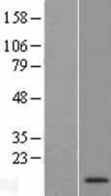 Western Blot C9orf170 Overexpression Lysate