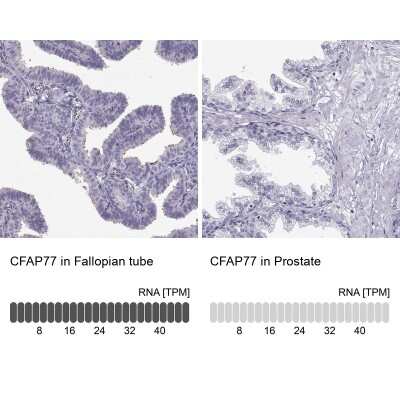 Immunohistochemistry-Paraffin: C9orf171 Antibody [NBP2-62635] - Immunohistochemistry analysis in human fallopian tube and prostate tissues using Anti-CFAP77 antibody. Corresponding CFAP77 RNA-seq data are presented for the same tissues.