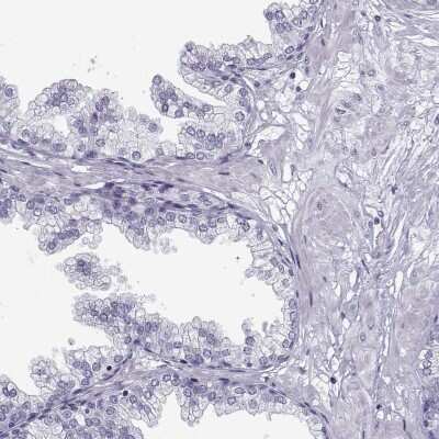 Immunohistochemistry-Paraffin: C9orf171 Antibody [NBP2-62635] - Staining of human prostate shows low expression as expected.