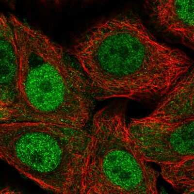 Immunocytochemistry/ Immunofluorescence RPP25L Antibody - BSA Free