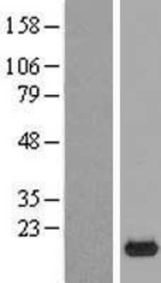Western Blot: C9orf23 Overexpression Lysate (Adult Normal) [NBP2-05426] Left-Empty vector transfected control cell lysate (HEK293 cell lysate); Right -Over-expression Lysate for C9orf23.