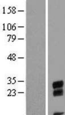 Western Blot: C9orf24 Overexpression Lysate (Adult Normal) [NBL1-08591] Left-Empty vector transfected control cell lysate (HEK293 cell lysate); Right -Over-expression Lysate for C9orf24.