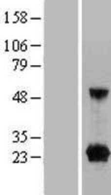 Western Blot FAM219A Overexpression Lysate