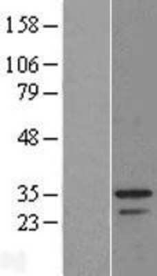 Western Blot: C9orf30 Overexpression Lysate (Adult Normal) [NBL1-08593] Left-Empty vector transfected control cell lysate (HEK293 cell lysate); Right -Over-expression Lysate for C9orf30.