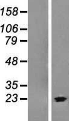 Western Blot: C9orf37 Overexpression Lysate (Adult Normal) [NBL1-08594] Left-Empty vector transfected control cell lysate (HEK293 cell lysate); Right -Over-expression Lysate for C9orf37.