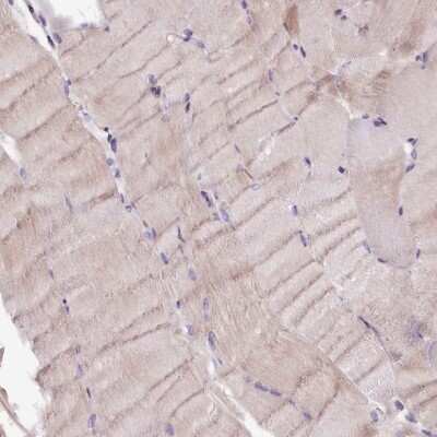 Immunohistochemistry-Paraffin: C9orf40 Antibody [NBP1-90447] - Staining of human skeletal muscle shows low expression as expected.