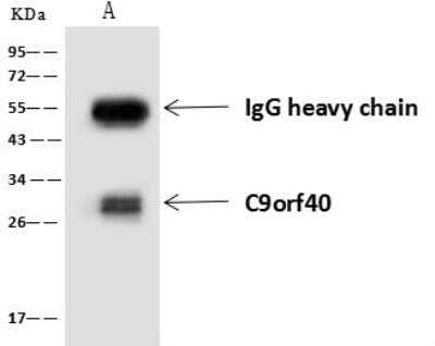 Immunoprecipitation: C9orf40 Antibody [NBP3-05929] - Lane A:0.5 mg HeLa Whole Cell Lysate4 uL anti-C9orf40 rabbit polyclonal antibody and 60 ug of Immunomagnetic beads Protein A/G.Primary antibody:Anti-C9orf40 rabbit polyclonal antibody,at 1:100 dilution Secondary antibody:Goat Anti-Rabbit IgG (H+L)/HRP at 1/10000 dilutionDeveloped using the ECL technique.Performed under reducing conditions.Predicted band size: 21 kDaObserved band size :28 kDa