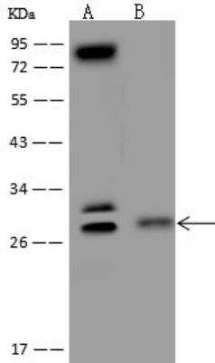 Western Blot: C9orf40 Antibody [NBP3-05929] - Lane A: HeLa Whole Cell LysateLane B: Jurkat Whole Cell LysateLysates/proteins at 30 ug per lane.SecondaryGoat Anti-Rabbit IgG (H+L)/HRP at 1/10000 dilution.Developed using the ECL technique.Performed under reducing conditions.Predicted band size:21 kDaObserved band size:28 kDa