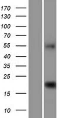 Western Blot: C9orf40 Overexpression Lysate (Adult Normal) [NBP2-06889] Left-Empty vector transfected control cell lysate (HEK293 cell lysate); Right -Over-expression Lysate for C9orf40.