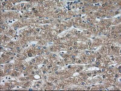 Immunohistochemistry-Paraffin: C9orf41 Antibody (4B7) [NBP2-02664] - Staining of paraffin-embedded Human liver tissue using anti-C9orf41 mouse monoclonal antibody.