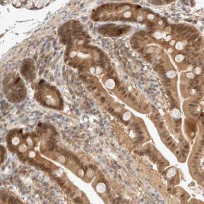 Immunohistochemistry-Paraffin: CARNMT1 Antibody [NBP1-82048] -  Staining of human duodenum shows moderate cytoplasmic and nuclear positivity in glandular cells.