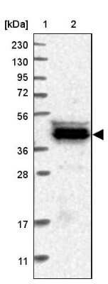 Western Blot: CARNMT1 Antibody [NBP1-82048] - Lane 1: Marker [kDa] 230, 130, 95, 72, 56, 36, 28, 17, 11Lane 2: Human cell line RT-4