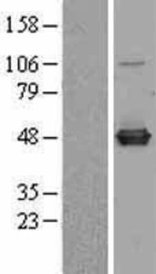 Western Blot: C9orf41 Overexpression Lysate (Adult Normal) [NBL1-08595] Left-Empty vector transfected control cell lysate (HEK293 cell lysate); Right -Over-expression Lysate for C9orf41.
