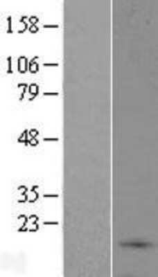 Western Blot: C9orf46 Overexpression Lysate (Adult Normal) [NBL1-08597] Left-Empty vector transfected control cell lysate (HEK293 cell lysate); Right -Over-expression Lysate for C9orf46.