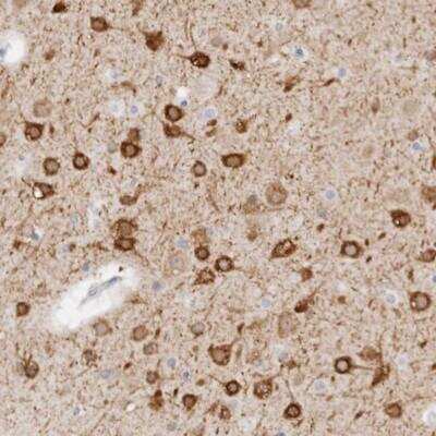 <b>Orthogonal Strategies Validation. </b>Immunohistochemistry-Paraffin: C9orf50 Antibody [NBP1-93824] - Staining of human cerebral cortex shows strong cytoplasmic positivity in neurons.