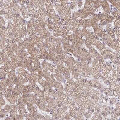 Immunohistochemistry: C9orf64 Antibody [NBP2-49155] - Staining of human liver shows moderate cytoplasmic positivity in hepatocytes.