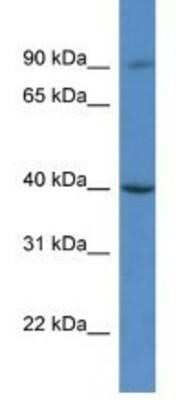 Western Blot: C9orf64 Antibody [NBP1-91505] - Hela Cell Lysate 1ug/ml  Gel Concentration 12%