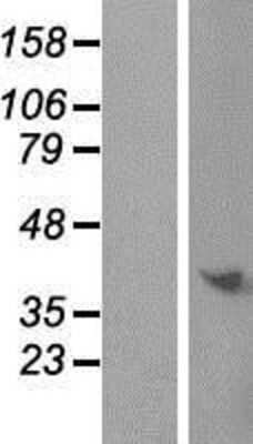 Western Blot: C9orf64 Overexpression Lysate (Adult Normal) [NBP2-06048] Left-Empty vector transfected control cell lysate (HEK293 cell lysate); Right -Over-expression Lysate for C9orf64.