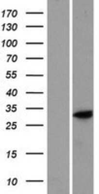 Western Blot: C9orf66 Overexpression Lysate (Adult Normal) [NBP2-05337] Left-Empty vector transfected control cell lysate (HEK293 cell lysate); Right -Over-expression Lysate for C9orf66.