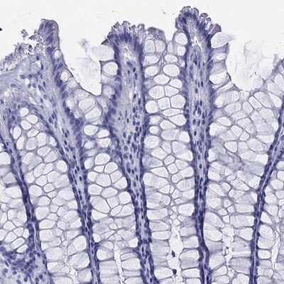 Immunohistochemistry-Paraffin: C9orf71 Antibody [NBP3-16962] - Staining of human rectum shows low expression as expected.