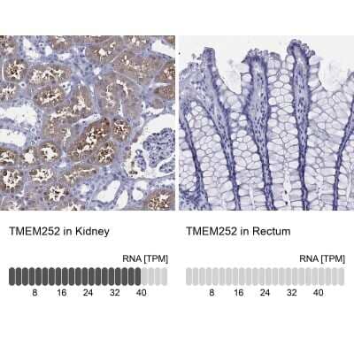 Immunohistochemistry-Paraffin: C9orf71 Antibody [NBP3-16962] - Analysis in human kidney and rectum tissues using Anti-TMEM252 antibody. Corresponding TMEM252 RNA-seq data are presented for the same tissues.