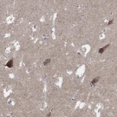 Immunohistochemistry-Paraffin: C9orf85 Antibody [NBP3-17573] - Staining of human hippocampus shows strong cytoplasmic positivity in neuronal cells.