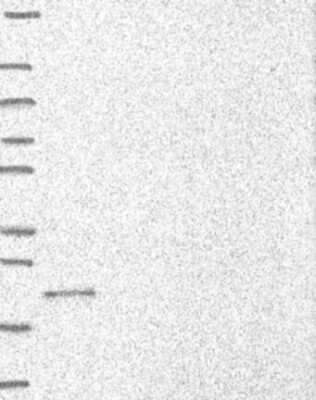 Western Blot: C9orf85 Antibody [NBP3-17573] - Lane 1: Marker [kDa] 250, 130, 95, 72, 55, 36, 28, 17, 10;   Lane 2: RT4;   Lane 3: U-251 MG;   Lane 4: Human Plasma;   Lane 5: Liver;   Lane 6: Tonsil