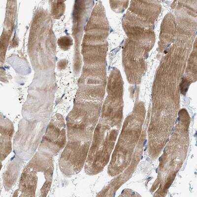 Immunohistochemistry: C9orf93 Antibody [NBP1-90785] - Staining of human skeletal muscle shows moderate cytoplasmic positivity.