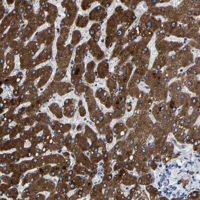 Immunohistochemistry: C9orf93 Antibody [NBP1-90786] - Staining of human liver shows strong cytoplasmic positivity in hepatocytes.