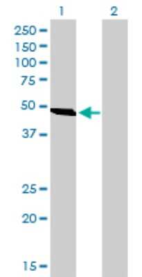 Western Blot: C9orf98 Antibody (3B8) [H00158067-M01] - Analysis of C9orf98 expression in transfected 293T cell line by C9orf98 monoclonal antibody (M01), clone 3B8.Lane 1: C9orf98 transfected lysate(54.9 KDa).Lane 2: Non-transfected lysate.