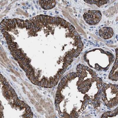 Immunohistochemistry-Paraffin: Adenylate Kinase 8 Antibody [NBP1-88243] - Staining of human prostate shows strong cytoplasmic and membranous positivity in glandular cells.