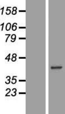 Western Blot: CA10 Overexpression Lysate (Adult Normal) [NBP2-08423] Left-Empty vector transfected control cell lysate (HEK293 cell lysate); Right -Over-expression Lysate for CA10.