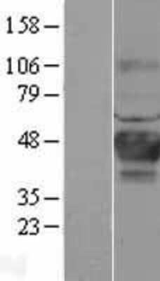 Western Blot: CA12 Overexpression Lysate (Adult Normal) [NBL1-08612] Left-Empty vector transfected control cell lysate (HEK293 cell lysate); Right -Over-expression Lysate for CA12.